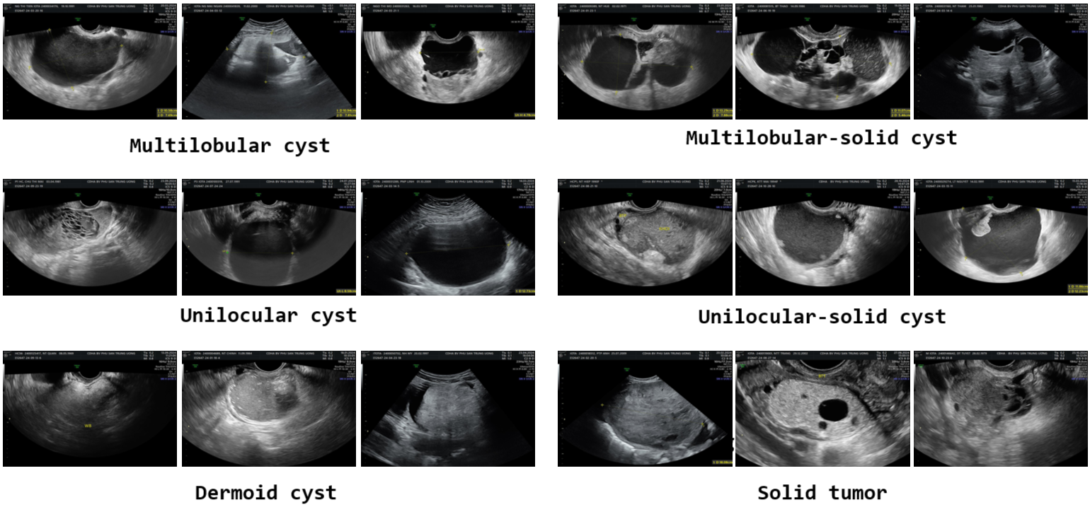 OvaTUS Dataset